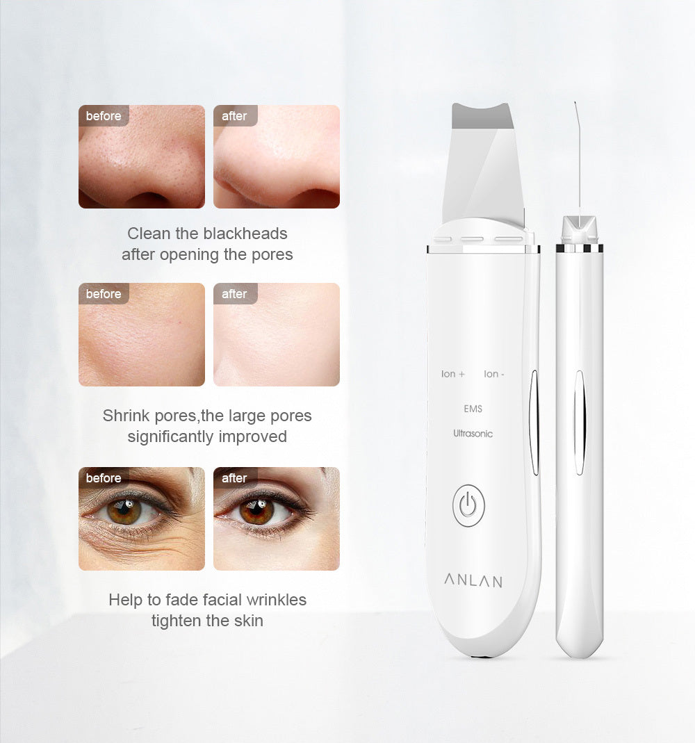 GlowWave Ultrasonic Face Cleaner | Spa Facial Device

LumiScrub Ultrasonic Wand | Deep Pore Cleanse

FreshGlow Face Scrubber | Spa-Style Skincare Tool

PureWave Ultrasonic Facial | Smooth Skin Therapy

SkinRadiance Ultrasonic Wand | Deep Cleansing Device

AquaPulse Face Scrubber | Professional Skincare at Home

UltraGlow Facial Scrubber | Pore & Skin Revitalizer

LumiLift Ultrasonic Face Tool | Spa Facial Cleanse

GlowMist Facial Scrubber | Home Spa Experience

RadianceWave Ultrasonic Device | Deep Skin Ren